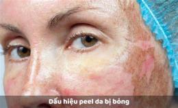 ảnh chụp màn hình dấu hiệu peel da bị bỏng