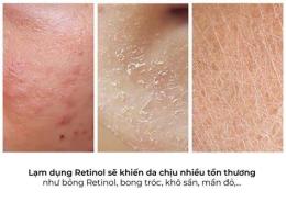 ảnh chụp màn hình dùng retinol bị bong da