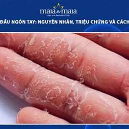 bong tróc da tay