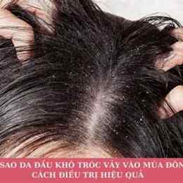 cách trị da đầu khô bong tróc tại nhà