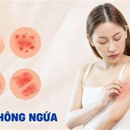 da nổi bông