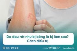 giao diện app da đau rát như bị bỏng