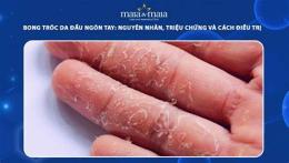 giao diện app da tay bị bong tróc là bệnh gì