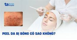 giao diện app hình ảnh peel da bị bỏng
