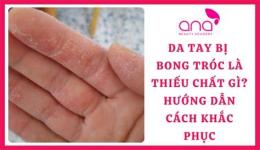 hướng dẫn sử dụng bong da tay là thiếu chất gì
