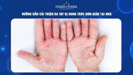 hướng dẫn sử dụng da tay bị bong tróc bôi thuốc gì
