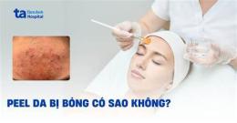 hướng dẫn sử dụng dấu hiệu peel da bị bỏng