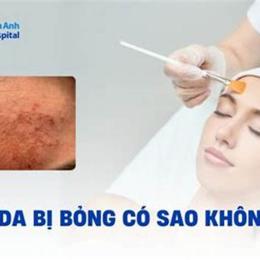 peel da bị bỏng