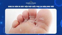 tính năng nổi bật bị bong da chân
