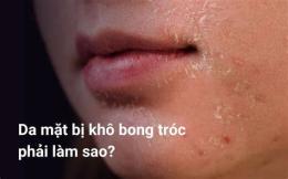 tính năng nổi bật da mặt bị khô bong tróc phải làm sao