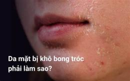 tính năng nổi bật da mặt khô bong tróc mùa đông