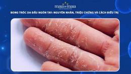 tính năng nổi bật da tay bị bong tróc là bệnh gì